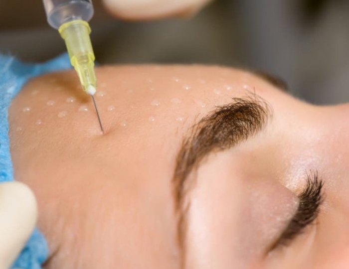 Мезотерапия - Санаторий «Виктория» Ессентуки