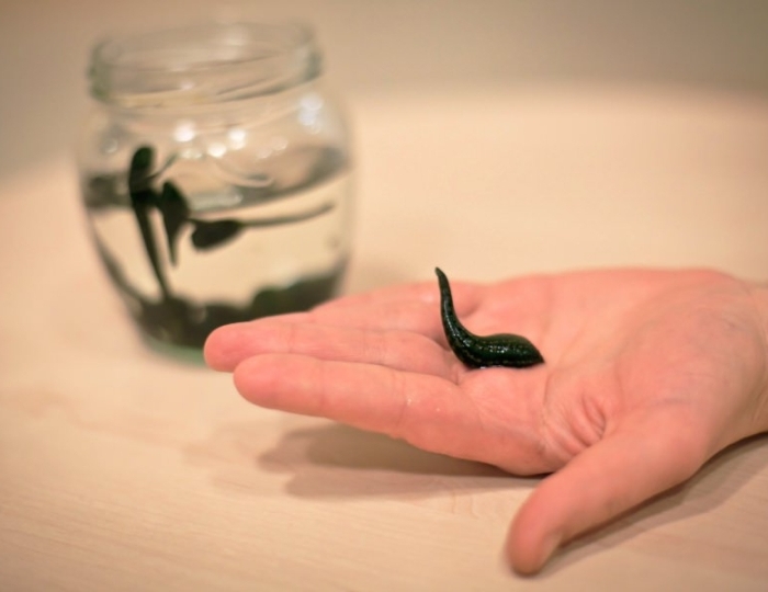 Гирудотерапия - Оздоровительные услуги - Санаторий «Виктория» Ессентуки